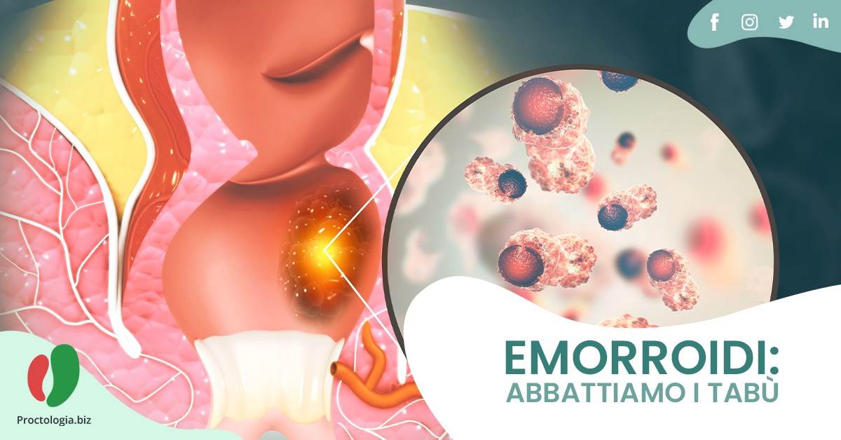 Emorroidi: abbattiamo il tabù delle patologie anali