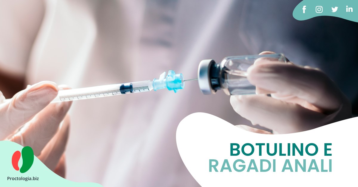 Iniezioni di Botulino per le Ragadi Anali Croniche