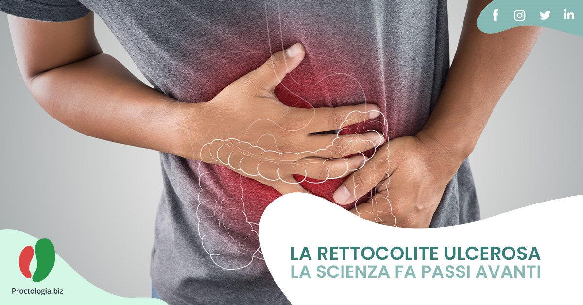 La rettocolite ulcerosa: la scienza fa passi avanti