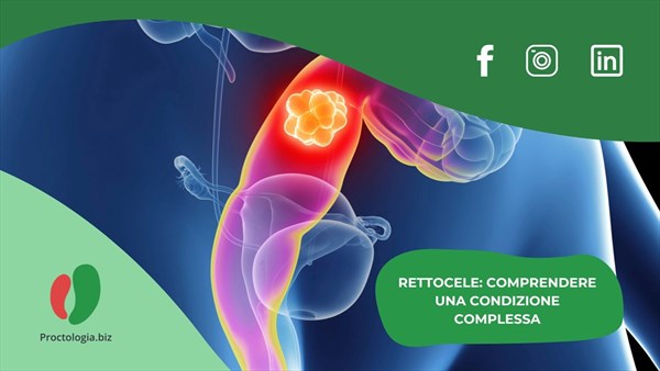 Rettocele: comprendere una condizione complessa